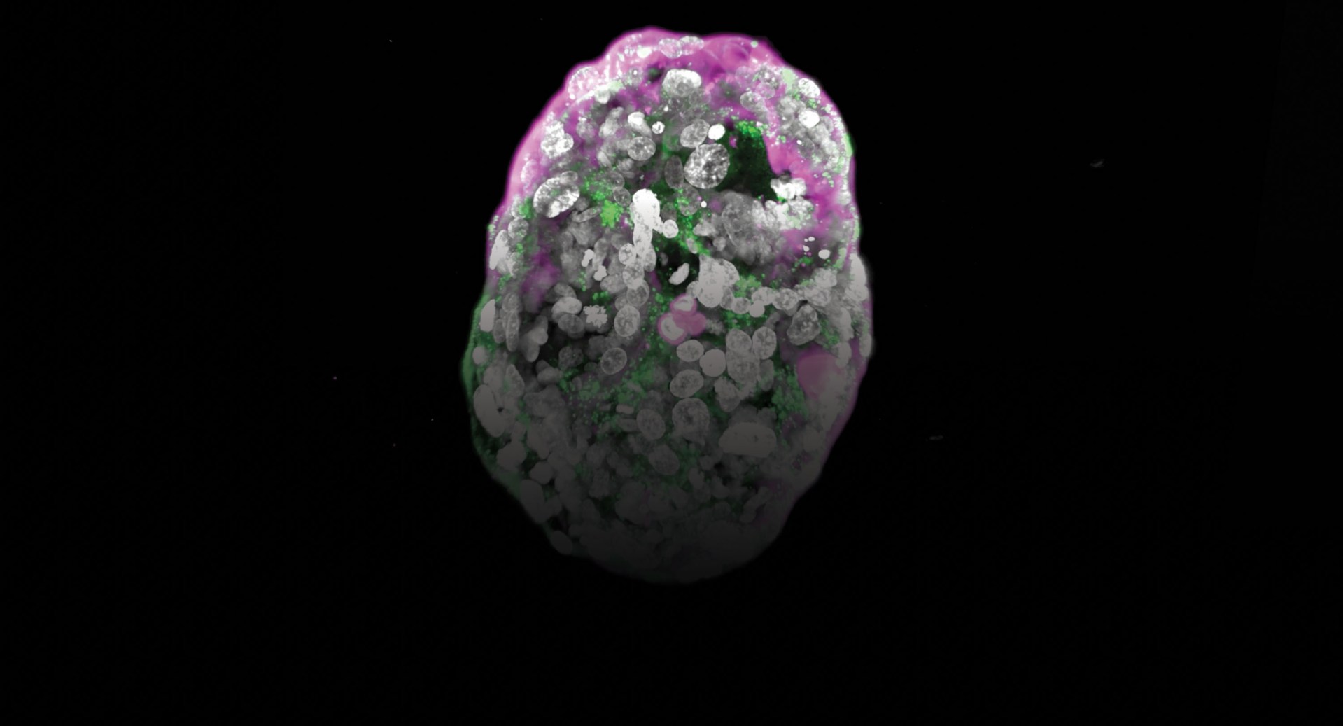 A three-dimensional scientific visualization of an egg-shaped structure with gray, white, green, and magenta coloring against a black background.